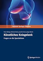 Télécharger le livre :  Künstliches Kniegelenk