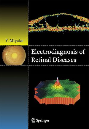 Téléchargez le livre :  Electrodiagnosis of Retinal Disease