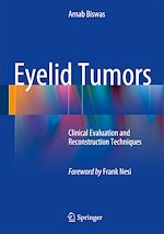 Télécharger le livre :  Eyelid Tumors