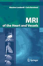 Télécharger le livre :  MRI of the Heart and Vessels
