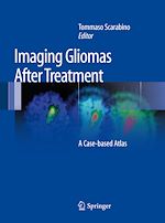 Télécharger le livre :  Imaging Gliomas After Treatment