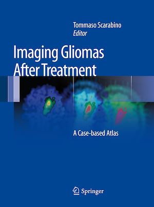 Téléchargez le livre :  Imaging Gliomas After Treatment