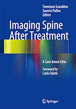 Télécharger le livre :  Imaging Spine After Treatment