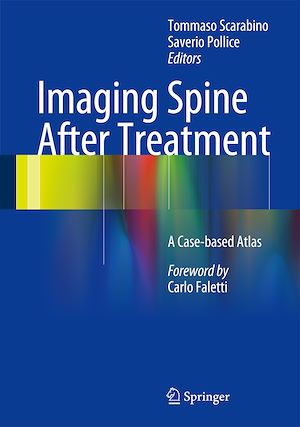 Téléchargez le livre :  Imaging Spine After Treatment