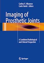 Télécharger le livre :  Imaging of Prosthetic Joints