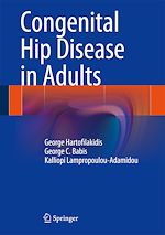 Télécharger le livre :  Congenital Hip Disease in Adults