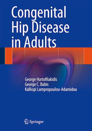 Téléchargez le livre :  Congenital Hip Disease in Adults