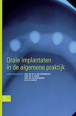 Download this eBook Orale implantaten in de algemene praktijk