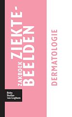 Download this eBook Zakboek ziektebeelden - Dermatologie