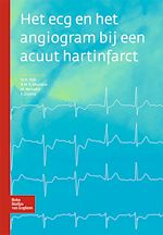 Download this eBook Het ecg en het angiogram bij een acuut hartinfarct