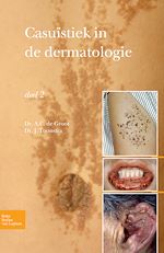 Download this eBook Casuïstiek in de dermatologie - deel 2