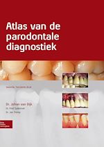 Download this eBook Atlas van de parodontale diagnostiek
