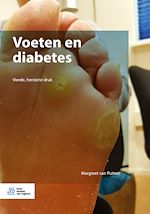 Télécharger le livre :  Voeten en diabetes