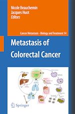 Télécharger le livre :  Metastasis of Colorectal Cancer