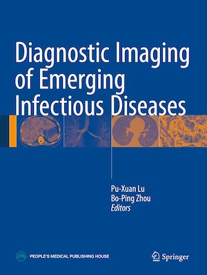 Téléchargez le livre :  Diagnostic Imaging of Emerging Infectious Diseases