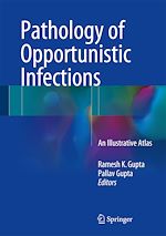 Télécharger le livre :  Pathology of Opportunistic Infections