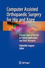 Télécharger le livre :  Computer Assisted Orthopaedic Surgery for Hip and Knee