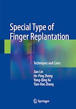 Télécharger le livre :  Special Type of Finger Replantation