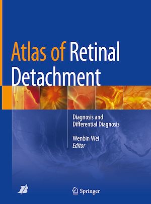 Téléchargez le livre :  Atlas of Retinal Detachment