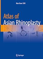 Télécharger le livre :  Atlas of Asian Rhinoplasty
