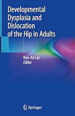 Télécharger le livre :  Developmental Dysplasia and Dislocation of the Hip in Adults
