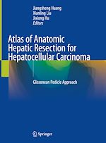 Télécharger le livre :  Atlas of Anatomic Hepatic Resection for Hepatocellular Carcinoma