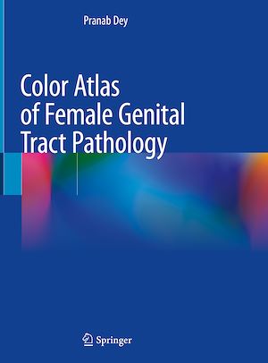 Téléchargez le livre :  Color Atlas of Female Genital Tract Pathology