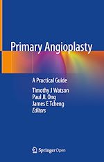 Download this eBook Primary Angioplasty