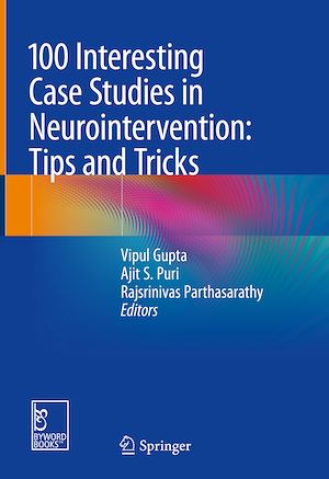 Télécharger le livre :  100 Interesting Case Studies in Neurointervention: Tips and Tricks