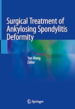 Télécharger le livre :  Surgical Treatment of Ankylosing Spondylitis Deformity