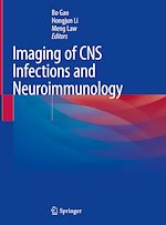 Télécharger le livre :  Imaging of CNS Infections and Neuroimmunology