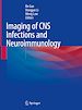 Télécharger le livre :  Imaging of CNS Infections and Neuroimmunology