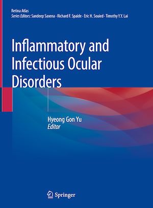 Téléchargez le livre :  Inflammatory and Infectious Ocular Disorders