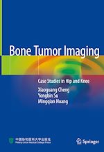 Télécharger le livre :  Bone Tumor Imaging