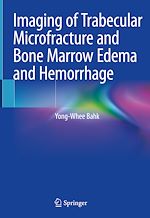 Télécharger le livre :  Imaging of Trabecular Microfracture and Bone Marrow Edema and Hemorrhage