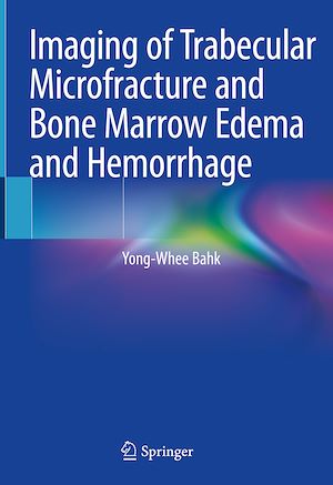 Télécharger le livre :  Imaging of Trabecular Microfracture and Bone Marrow Edema and Hemorrhage
