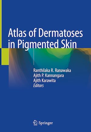Téléchargez le livre :  Atlas of Dermatoses in Pigmented Skin