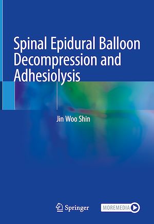 Téléchargez le livre :  Spinal Epidural Balloon Decompression and Adhesiolysis
