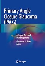 Télécharger le livre :  Primary Angle Closure Glaucoma (PACG)