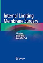 Télécharger le livre :  Internal Limiting Membrane Surgery