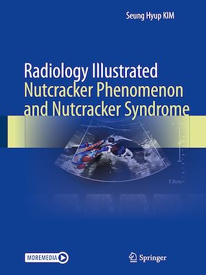 Téléchargez le livre :  Radiology Illustrated: Nutcracker Phenomenon and Nutcracker Syndrome