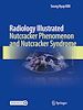 Télécharger le livre :  Radiology Illustrated: Nutcracker Phenomenon and Nutcracker Syndrome