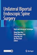 Télécharger le livre :  Unilateral Biportal Endoscopic Spine Surgery