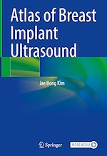 Télécharger le livre :  Atlas of Breast Implant Ultrasound