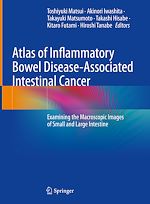 Télécharger le livre :  Atlas of Inflammatory Bowel Disease-Associated Intestinal Cancer