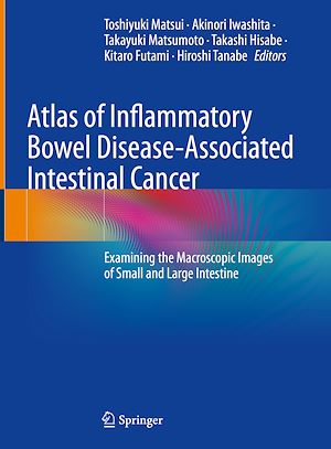 Téléchargez le livre :  Atlas of Inflammatory Bowel Disease-Associated Intestinal Cancer