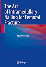 Télécharger le livre :  The Art of Intramedullary Nailing for Femoral Fracture