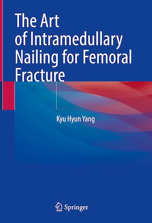 Téléchargez le livre :  The Art of Intramedullary Nailing for Femoral Fracture