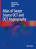 Télécharger le livre :  Atlas of Swept Source OCT and OCT Angiography