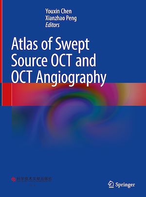 Téléchargez le livre :  Atlas of Swept Source OCT and OCT Angiography